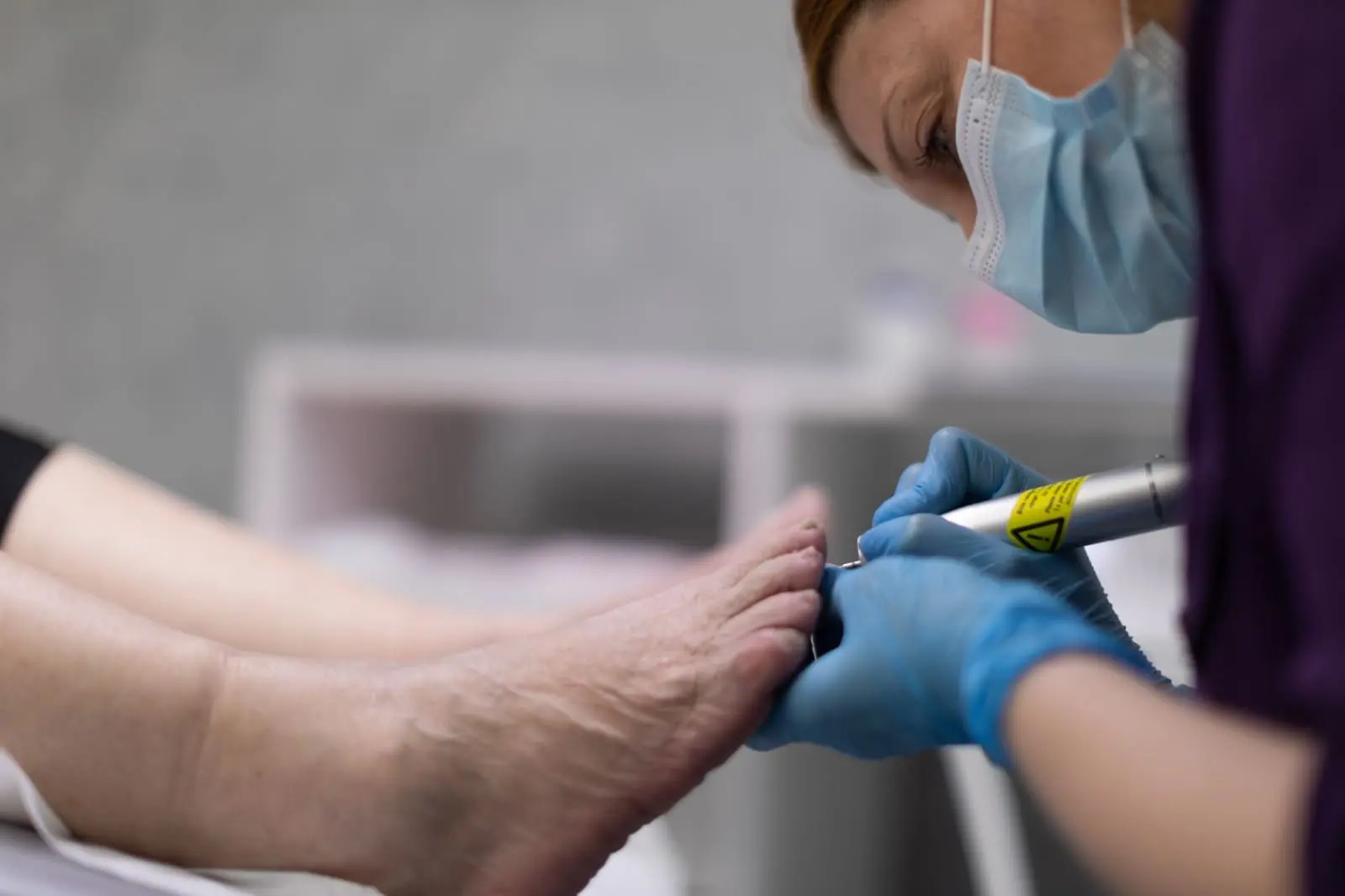 Top Signs That Indicate You Need a Diabetic Foot Screening